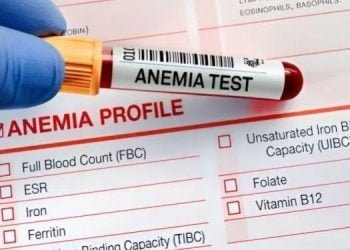 Anemi: Demir Eksikliği ve Sağlıklı Beslenme Önerileri 10 Demir Eksikliği ve Sağlıklı Beslenme Önerileri