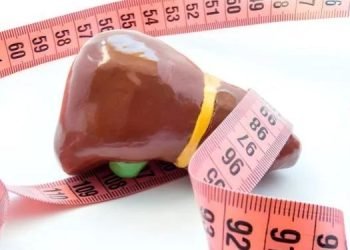 Karaciğer Yağlanması: Nedenleri, Belirtileri ve Öneriler 6 Karaciğer Yağlanması