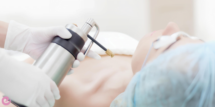 Kriyoterapi Nedir? Kriyoterapi Neden Yapılır? 2 Kriyoterapinin Yan Etkileri Nelerdir Yan Etkileri Kalıcı mıdır