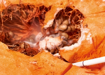 Sigaranın Zararları 13 Sigaranın Zararları